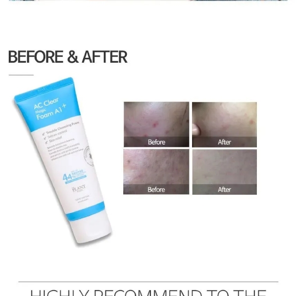 Review The Plant Base AC Clear Magic Cica Cream chân thực!